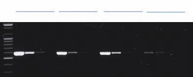 AccuPower ProFi Taq PCR PreMix For Long PCR (up to 30 kb) and High Fidelity PCR, Dried-type Premix Specifications Enzyme: ProFi Taq DNA polymerase 5 to 3 exonuclease: Yes 3 to 5 exonuclease: Yes 3 -