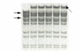 Thermostable Thermus filiformis (Tfi) DNA Ligase Experimental Data 1 2 3 4 5 6 1 2 3 4 5 6 7 8 9 10 1. Fragment 4. Fragment Ligation Product (1+4) Figure 1.