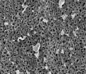 When it is amplified to 10,000 times, it can be clearly viewed that such tissues are made up of large number of crystallites.