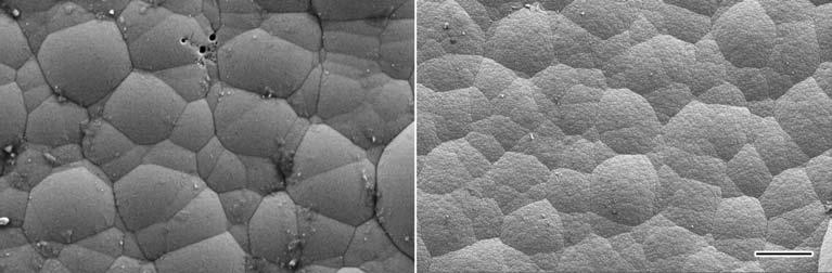 3 Surface morphologies of CE-plated (a) and MAE barrel-plated (b) Ni-P coatings on carbon steels after heat treatment at 400 C for 1 h P coatings exhibit the typical cauliflower-like surface, the