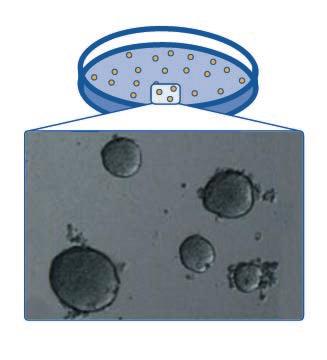 Colony forming assay After seeding in a matrix that enhances colony formation, such as a semi-solid
