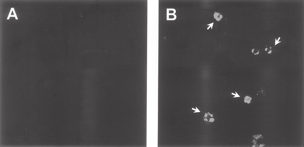 TUNEL Assay: Overview of Techniques 25 Fig. 2. Confocal micrograph of TUNEL-stained Jurkat T lymphocytes. (A) Untreated culture. (B) Fas ligand-treated culture undergoing apoptosis.