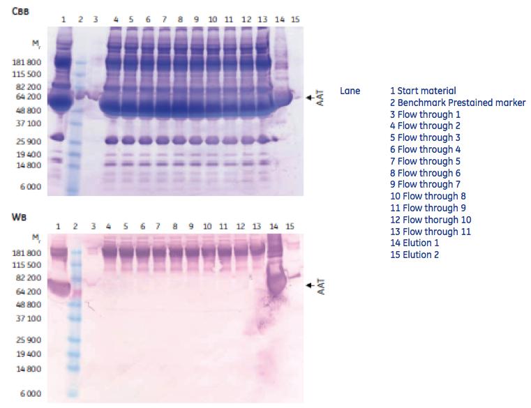 Enrichment of Alpha-1 Antitrypsin from Human Plasma The protein content of the starting material (plasma), the flow through fractions and 2 elution fractions are analyzed by gel electrophoreses and