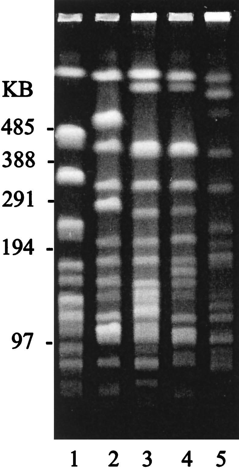 3038 QUEENAN ET AL. ANTIMICROB. AGENTS CHEMOTHER. FIG. 1. PFGE of SpeI-digested DNA from S. marcescens isolates. Lane 1, imipenem-sensitive strain SC 9782.