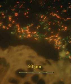 Gut microbiota in IBD Fluorescence
