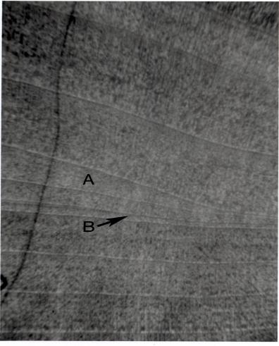 Plate 2-2 (above). Locally absent growth rings in Pacific madrone. The ring marked A decreases in thickness from left to right.