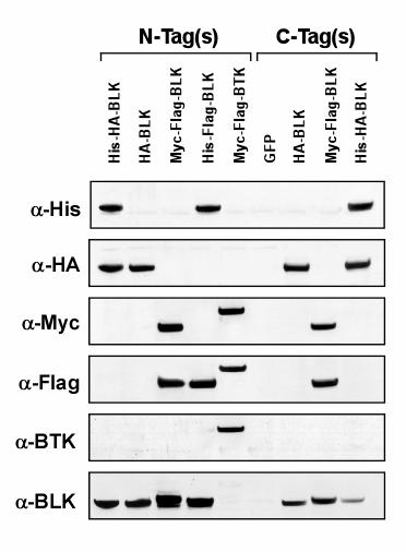 Figure 3. Western blot analysis of proteins expressed from N-terminally and C-terminally tagged PrecisionShuttle vectors.