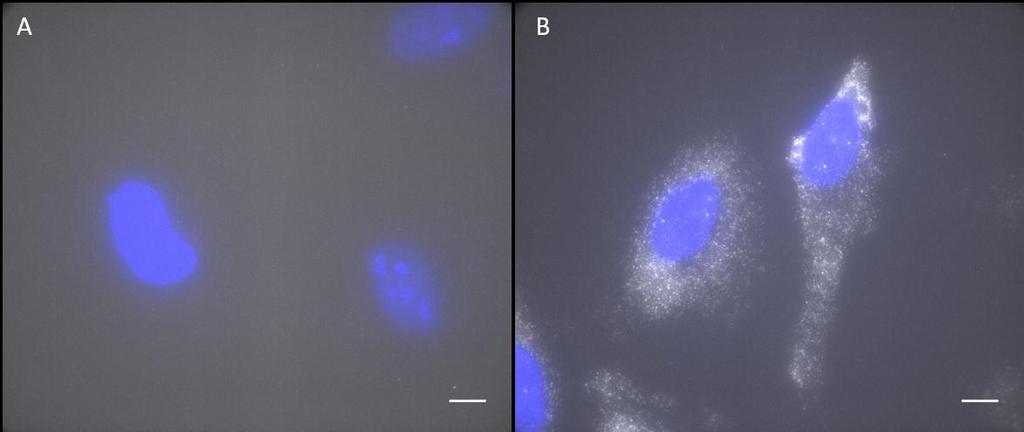Supplementary Figure 1 Retention of RNA with LabelX. (a) Epi-fluorescence image of single molecule FISH (smfish) against GAPDH on HeLa cells expanded without LabelX treatment.