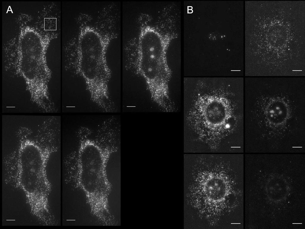 Supplementary Figure 6 Serially hybridized and multiplexed ExFISH. (a) Five consecutive widefield fluorescence images (top to bottom, then left to right) of GAPDH, applied to the cell of Fig. 2a.