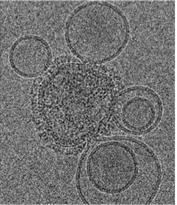 Image 5: Cryo electron microscopy Magnification: 3,750,000x Influenza virus fusing with liposomes The image shows influenza virus (in the middle), covered with protein spikes, fusing with spherical