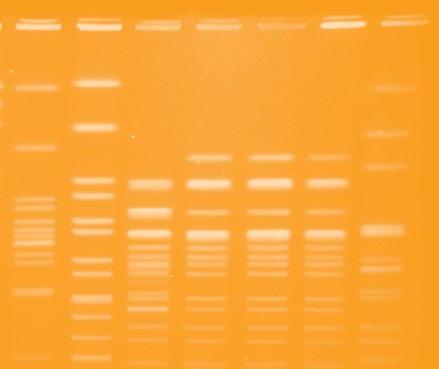 applied to release DNA caught in the gel matrix to further enhance the separation and resolution of very large DNA molecules FIGE and AFIGE functions enable enhanced and rapid resolution of small