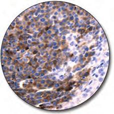expression. The antibody is not intended for use in tissue typing.