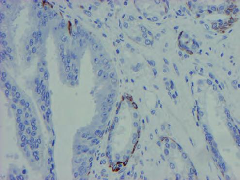 (LINKER) Pre-treatment Antibody Labeling Visualization Counterstain and Mounting * Onboard Dako Omnis, the blocking step is performed after primary antibody incubation.