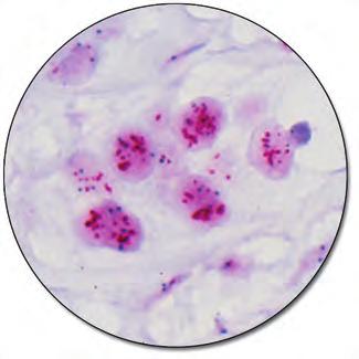 breast cancer tissue specimens using bright field microscopy.