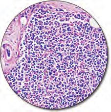 Gomori's Blue Trichrome Stain Kit, Artisan C AR167 Ready-to-use 50 tests Gomori's Blue Trichrome Stain Kit is used to identify collagen fibers in liver and kidney tissue sections on the Artisan Link