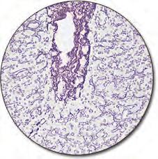 tissue sections on the Artisan Link and Artisan Link Pro Staining Systems. An Ammoniacal Silver Nitrate solution is applied to stain the reticulin fibers in tissue.