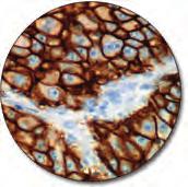 ml Lung tissue (FFPE) stained with FLEX Anti- Cytomegalovirus, Code IR752/IS752.