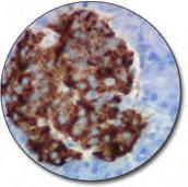 (FFPE) stained with FLEX Anti-IgG, Code IR512/IS512.