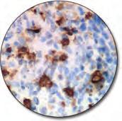 Primary Antibodies (FLEX Ready-to-Use) (Autostainer Link) (continued) Mast Cell