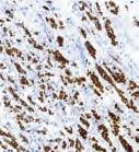 Overview of FLEX Ready-to-Use Antibodies (continued) FLEX RTU Antibodies Breast Tissue Page Anti- Clone 76 BCL2 Oncoprotein