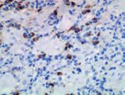 Antibodies and Controls Advanced Staining Solutions FLEX RTU Antibodies Endocrine System Page Anti- Clone General