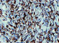 84 CD45, Leucocyte Common Antigen 2B11 + PD7/ 26 88 CDX2 DAK-CDX2 92 Desmin D33 92 E-Cadherin NCH-38 104 MUC2 CCP58 105 MUC5AC