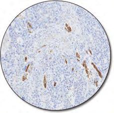 Primary Antibodies (continued) Polyclonal Rabbit Anti-Human Alpha-1-Fetoprotein Formalin HIER C A0008 Ig fraction 0.