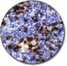 The antibody is a useful aid for classification of CD56+ T/NKcell lymphomas.