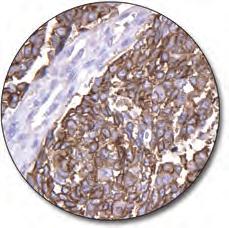 The antibody is of value for demonstration of monocytes and macrophages in normal and pathological specimens.