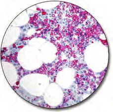 Within the hemopoietic system, CD138 is mainly confined to late stages of B-cell differentiation.