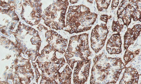 Advanced Staining Solutions Dako Omnis Solution for IHC and ISH FLEX Ready-to-Use Antibodies for Dako Omnis Page Code Product Package Size 27 74 GA505 Rb a Hu Alpha-1-Antitrypsin, Ready-to-Use (Dako
