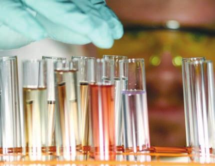 Urine Tests (Urinalysis) When myeloma is suspected, urine tests may be ordered.
