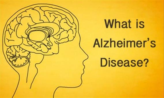 Alzheime's disease is the most common cause of dementia a goup of bain disodes that cause the loss of inteectual and social skis.