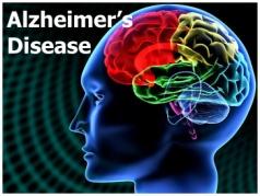 Results on Alzheime s disease Hospital admissions Hospital admission ates wee highe in study goup compaed to contol goup, age-adjusted: ORs vaied fom 1.18 to 1.43 (p<0.001), depending of a yea.