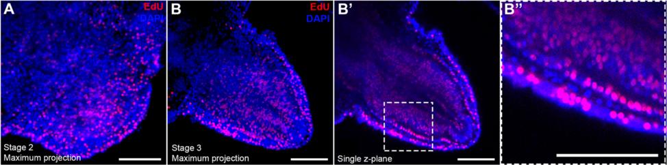 Czarkwiani et al. Frontiers in Zoology (2016) 13:18 Page 11 of 17 Fig. 7 Confocal images showing EdU labeling (red) of early stage regenerating arms counterstained with nuclear stain DAPI (blue).