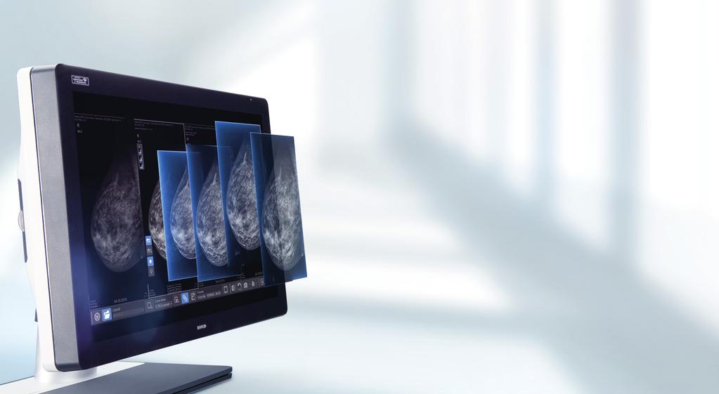 Quickly and easily explore precise, detailed 3D images via s full suite of advanced reading and workflow tools especially when paired with GE tomosynthesis equipment.
