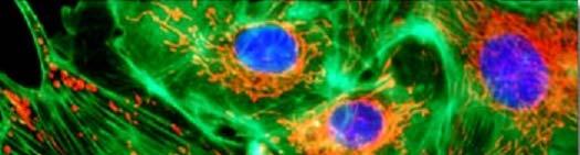 1) To visualize molecules (structures) in cells a) Using a fluorescent dye that t directly binds to the