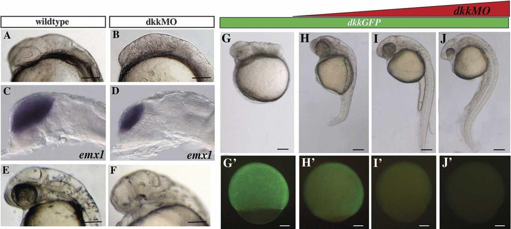 Dkk1 binds Kny and regulates gastrulation movements F), as predicted by previous studies of Dkk1 loss of function in Xenopus and mouse (Glinka et al. 1998; Mukhopadhyay et al. 2001).