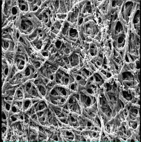 1443 SEM study of scaffolds with cells 9 10 4 cells/well Fibroblast cells were seeded on control TCP (Tissue Culture Plate), PCL nanofibrous layers made of PCL solution dissolved in