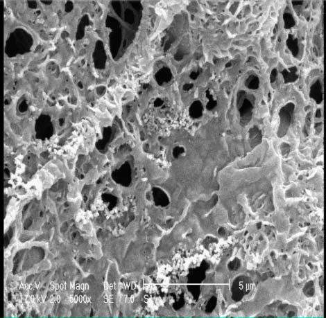 3 shows the SEM micrographs of cells morphology and interaction between cells and nanofibrous webs (PCL in 90AA (Fig.3a), PCL in MC/DMF (Fig. 3b), CS: PVA (Fig.