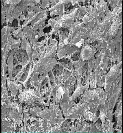 AS it can be seen fibroblast cells attached and spread on the surface of all scaffolds showed normal morphology (Fig.3).