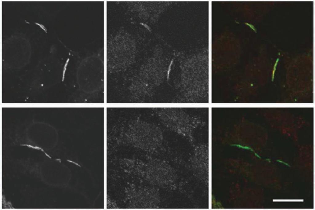 Effects of different types of permeabilisation CLDN7-EGFP Anti-CLDN7 Merge PFA and Triton PFA and MeOH Images of 293T cells expressing tight junction protein Claudin-7 EGFP (CLDN7-EGFP) immunostained