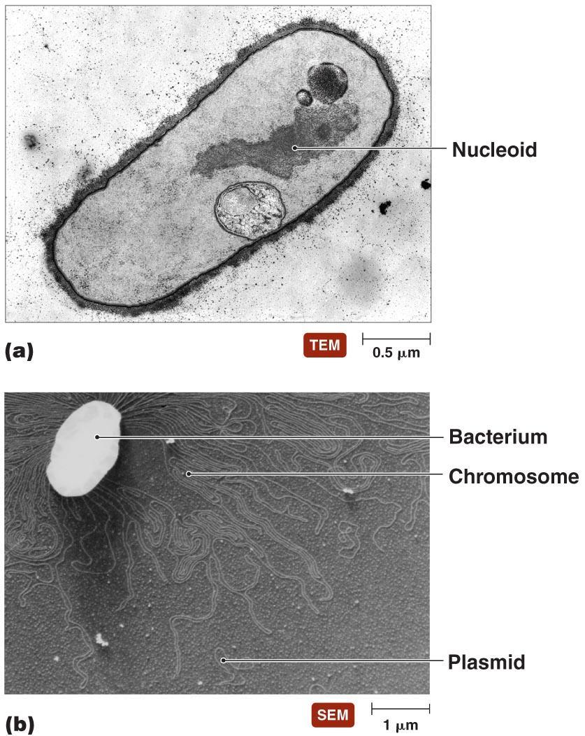 Bacterial