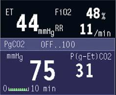 Haemodynamic monitoring Standard haemodynamic measurement of ECG, NIBP, up to six invasive blood pressure