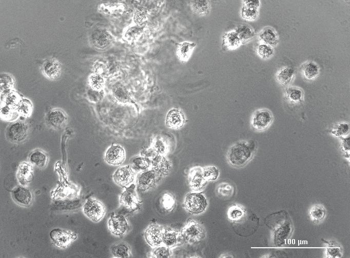 20x phase contrast images of MDA-MB-231 cells captured after (A) 0, (B) 7, and (C) 24 hour incubation with 40 µm oridonin.
