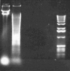Figure 9.3 Example Southern Blot.