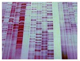 DNA Sequence and Genetic Markers 1977 Sanger and colleagues describe
