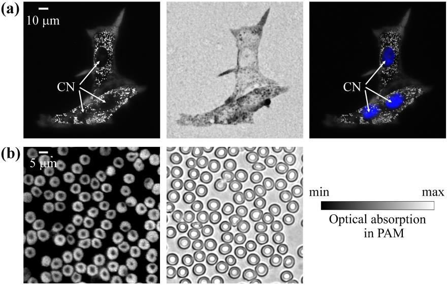 Figure 2.2 Ex vivo images of cells. (a) Melanoma cells grown on a cover glass and fixed. From left to right: PAM image, optical microscopy image (0.
