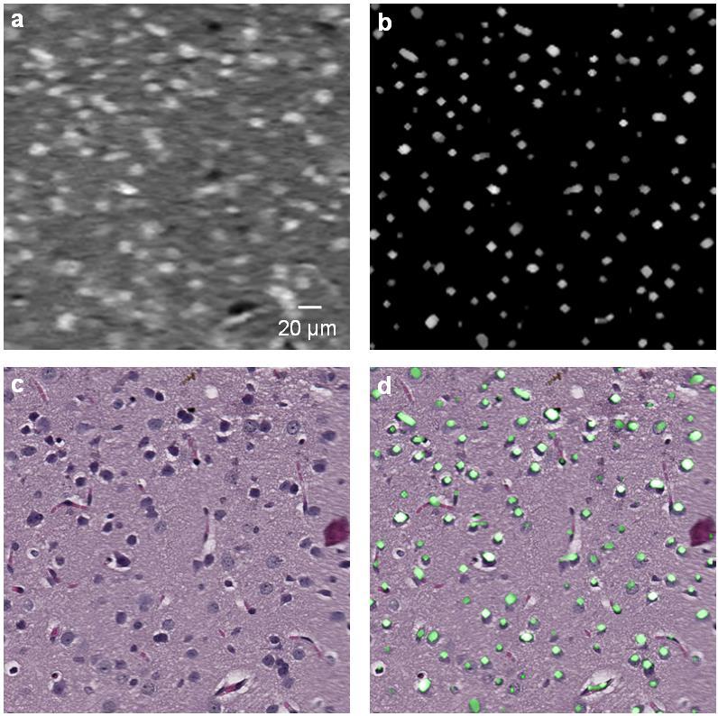 Figure 4.3 Extracting cell nuclei from SPAM images. (a) Label-free SPAM image. (b) Nuclei extracted from (a) by a Hessian filter. (c) Optical microscopy image acquired after H&E staining.