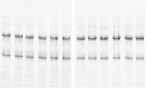 A). Protein A Mag Sepharose Xtra Recovery (%) Recovery (%) 1 9 8 7 6 5 4 3 2 1 1 9 8 7 6 5 4 3 2 1 1 2 3 4 5 6 Purification run B). 1 2 3 4 5 6 Purification run Fig 5.